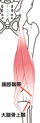 膝の画像